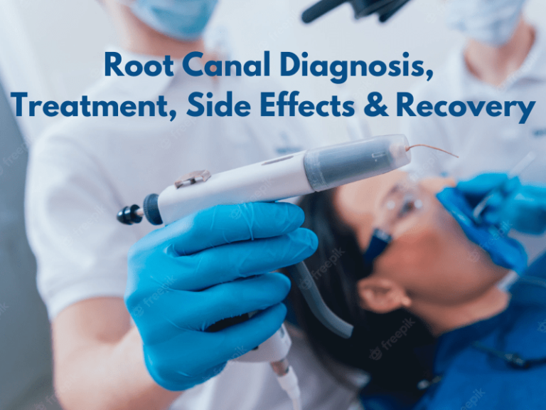 A Guide to Root Canal Diagnosis, Treatment, Side Effects, and Recovery