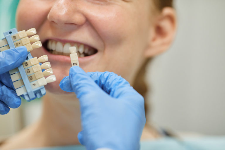Dental Implants: from Science to Smile