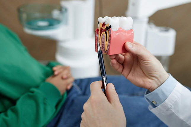 Root Canal Recovery Time: What You Need to Know