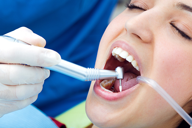 5 Factors That Affect Root Canal Recovery Time