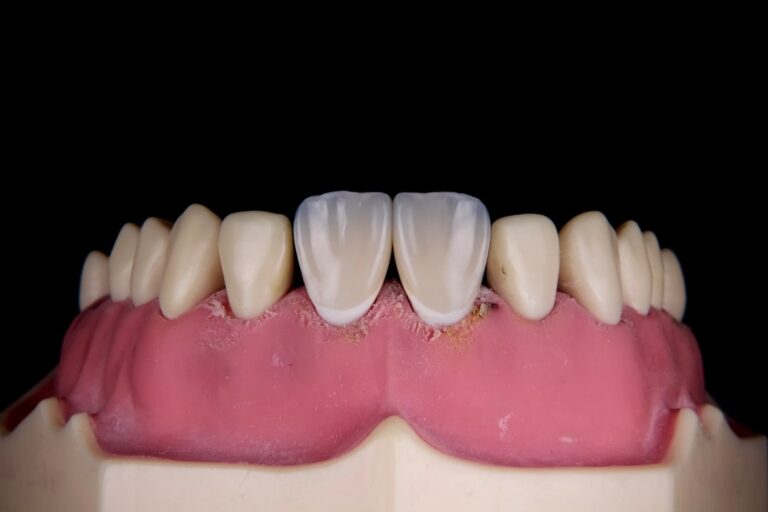 A Comprehensive Guide to Your New Grin