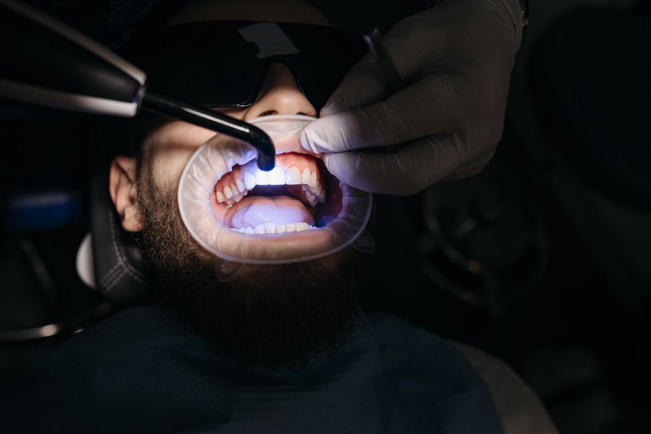 emergency chipped tooth repair