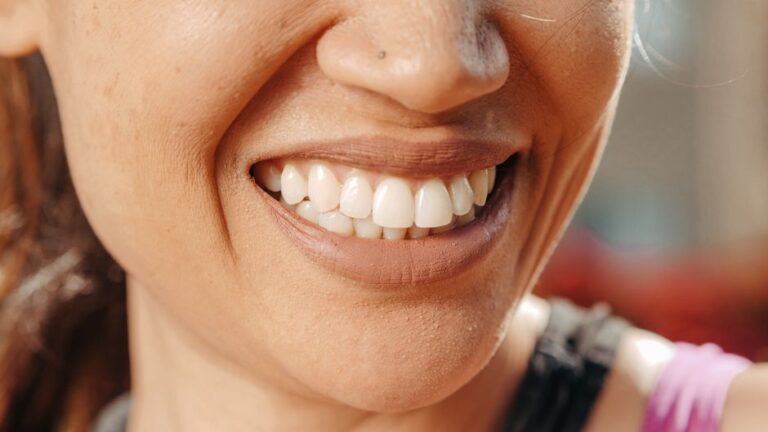 Witness the Magic of a Smile Makeover Before and After